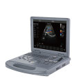 Laptop Color Doppler Ultrasound Machine